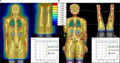 Optimized Conformal Total Body Irradiation methods with Helical TomoTherapy and Elekta VMAT: Implementation, Imaging, Planning and Dose Delivery for Pediatric Patients